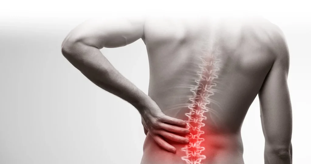 Chronic Back Pain